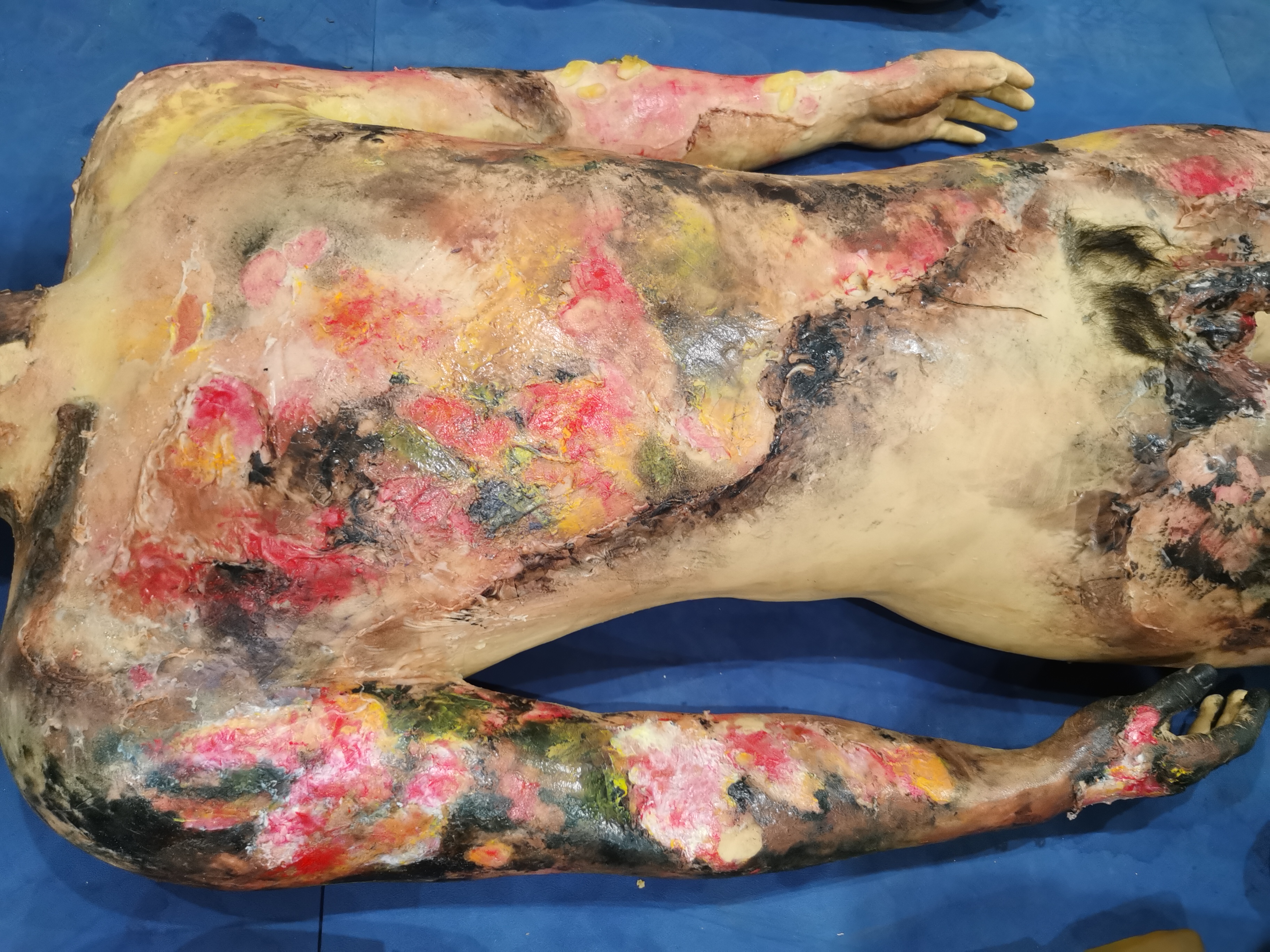 Full-body Burn Assessment Manikin